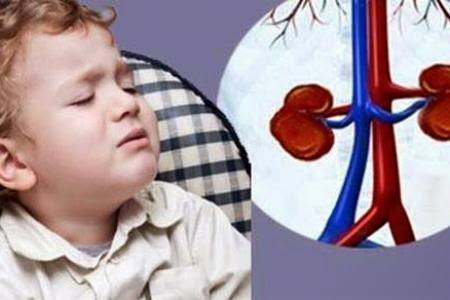 sỏi tiết niệu ở trẻ
