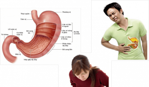 dấu hiệu loét dạ dày tá tràng