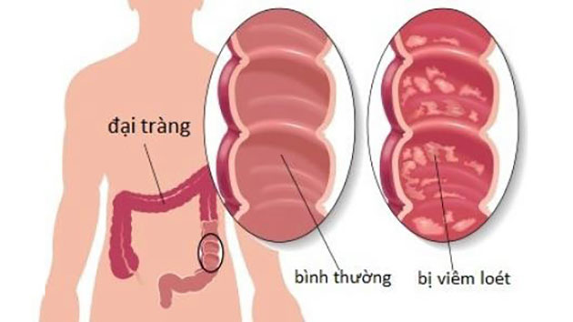 viem-dai-trang