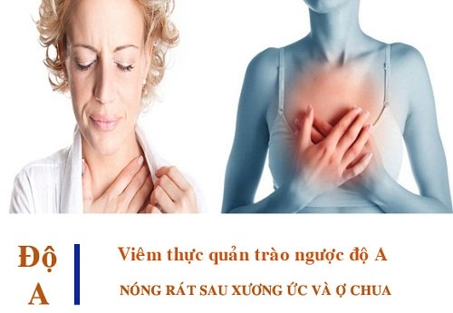 Trào ngược dạ dày