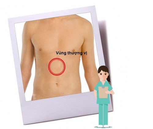 Đau thượng vị