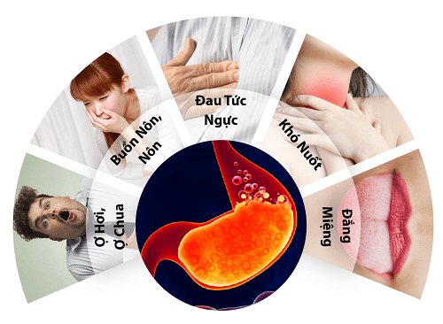 Thuốc giảm tăng tiết acid
