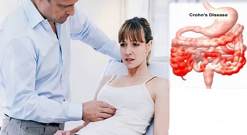 chẩn đoán và điều trị
