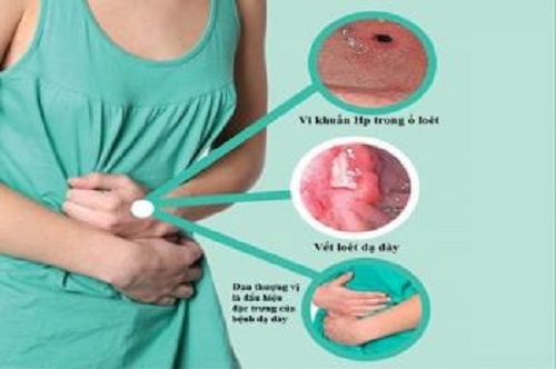 viêm loét dạ dày tá tràng