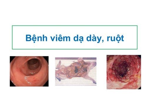 viem-da-day-ruot