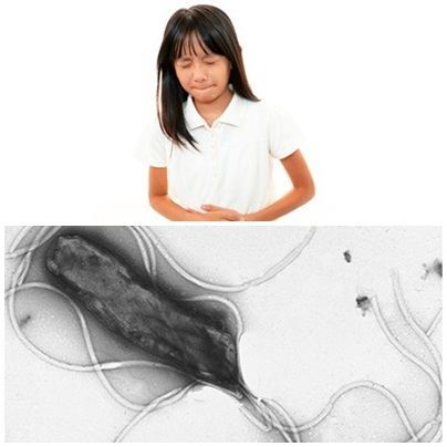 vi khuẩn hp ở trẻ em thường khó nhận biết hơn