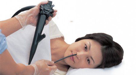 nội soi dạ dày thông qua mũi