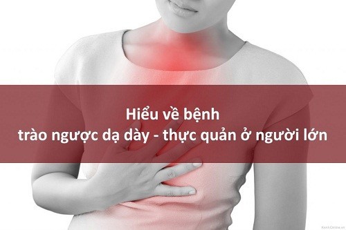 hiểu về trào ngược dạ dày