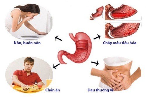 đau thượng vị