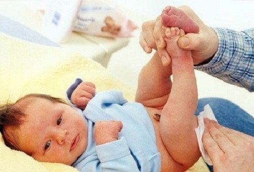 Táo bón ở trẻ sơ sinh