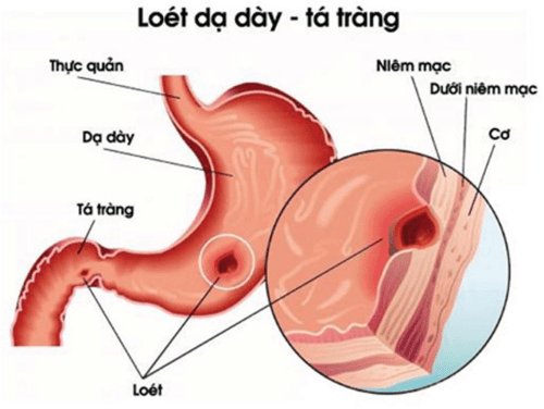 viem-loet-da-day