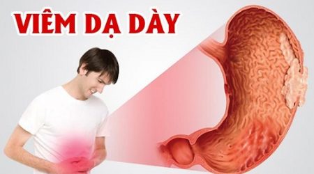 điều trị viêm dạ dày trong bao lâu